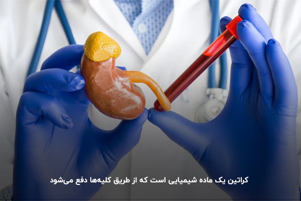 کراتین خون، ماده شیمیایی اضافه&zwnj;ای که توسط کلیه دفع می&zwnj;شود