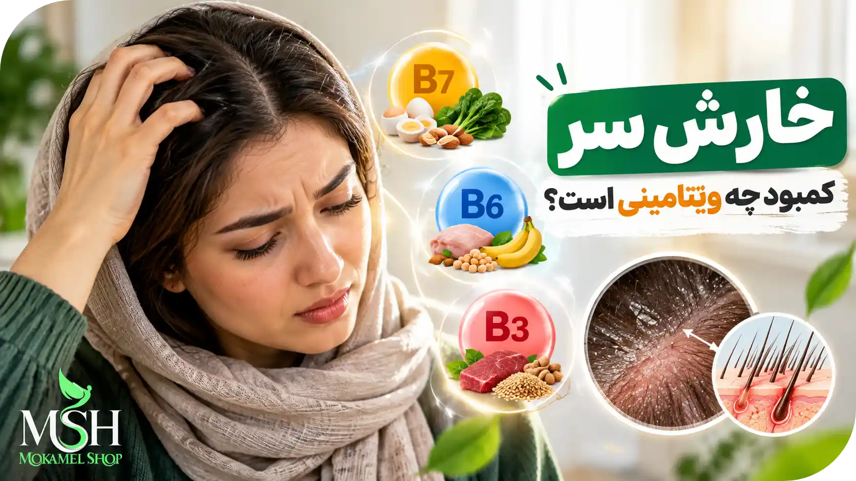 خارش سر کمبود چه ویتامینی است؟