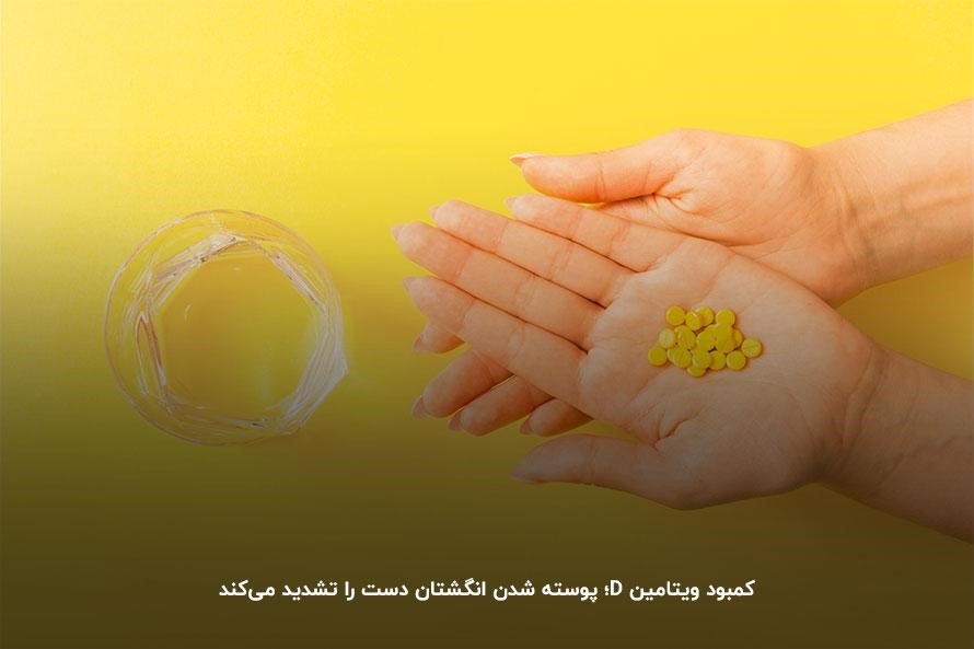 کمبود چه ویتامینی باعث پوسته شدن کف دست میشود؟