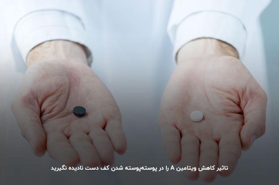 خوردن مکملهای ویتامین A بهترین راه پیشگیری از پوسته شدن دست