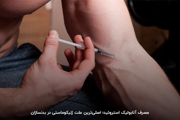 آشنایی با دلایل بروز ژنیکوماستی در بدنسازی