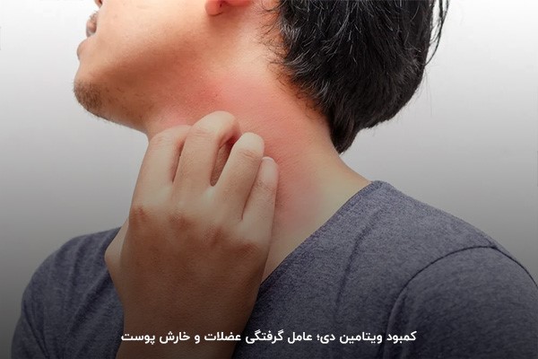 کمبود ویتامین d؛ یکی از اصلیترین دلایل اسپاسمهای عضلانی