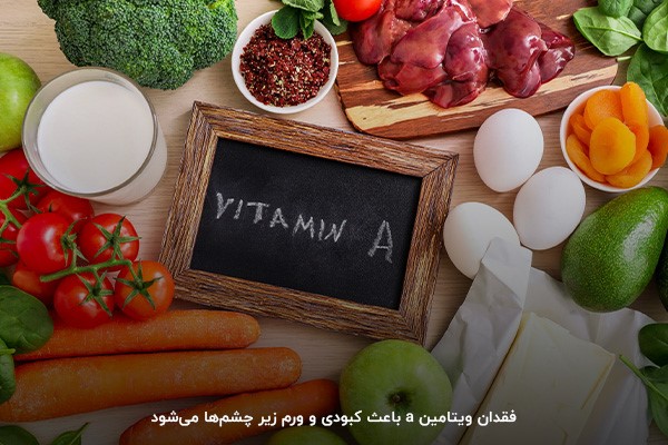 ویتامین آ؛ ویتامینی ضروری برای چشم&zwnj;ها