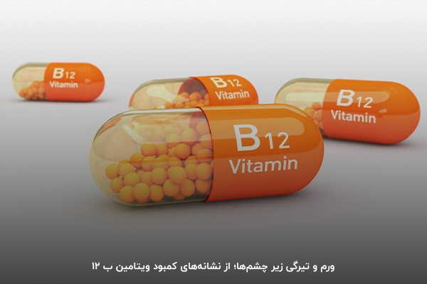 کمبود ویتامین ب 12؛ یکی از اصلی&zwnj;ترین دلایل پف زیر چشم