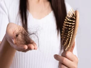 علل ریزش مو در بین زنان و دختران و روش های درمان آن (مطلب)