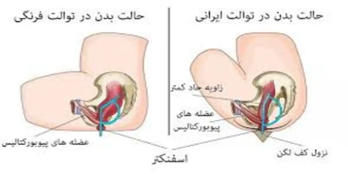 توالت فرنگی بهتره یا ایرانی