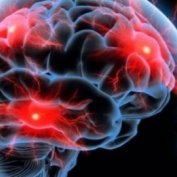 ويتامين ضد آلزايمر را بشناسيد