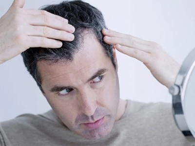 علت نازک شدن مو چیست؟ بررسی کامل دلایل، نشانه ها و روش های تقویت مو