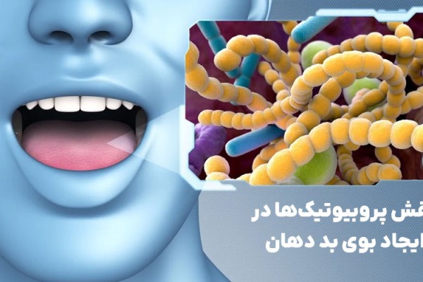 نقش پروبیوتیک‌ها در ایجاد بوی بد دهان