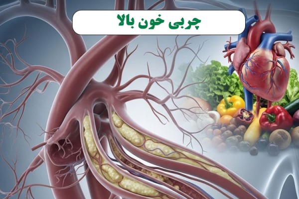 چربی خون بالا: دشمن پنهان رگ‌های شما!