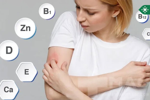 کمبود کدام ویتامین باعث خارش بدن می‌شود؟