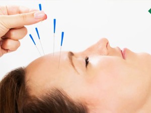 تبلیغاتِ تاثیر طب سوزنی در میگرن را تا چه‌حد باید جدی گرفت؟!