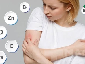 کمبود کدام ویتامین باعث خارش بدن می‌شود؟