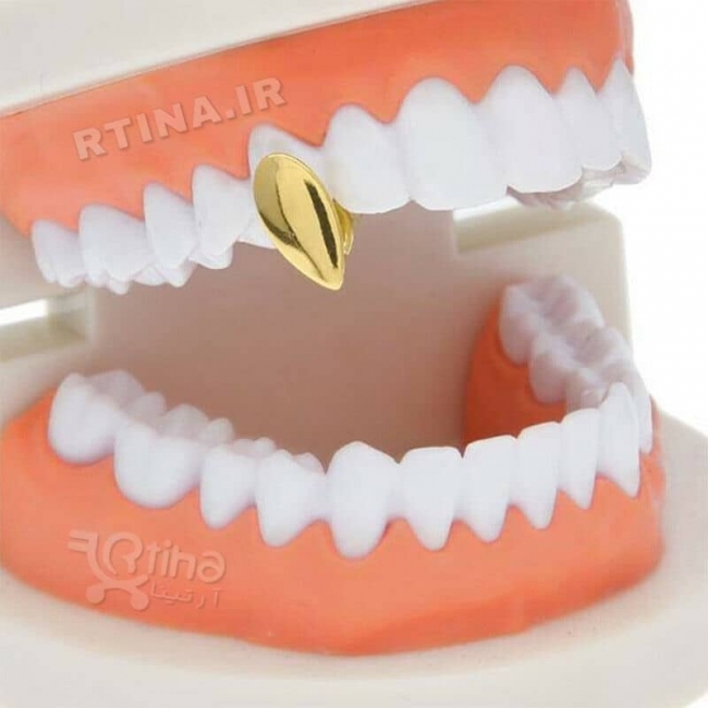 روکش تزئینی تک دندان مدل Vampire