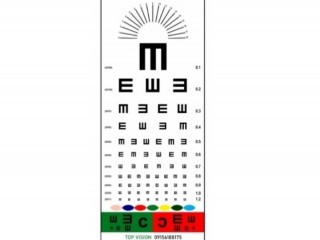 چارت کنترلی پلکسی