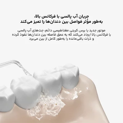 واتر جت شستشوی دهان و دندان شیائومی مدل Water Flosser 2 MEO705